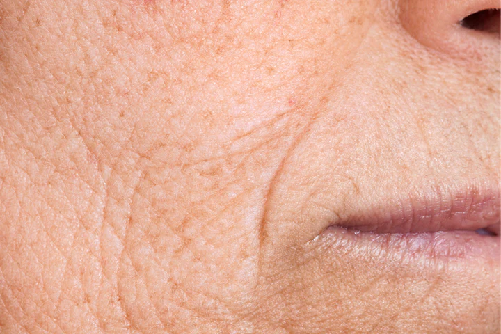 Ageing